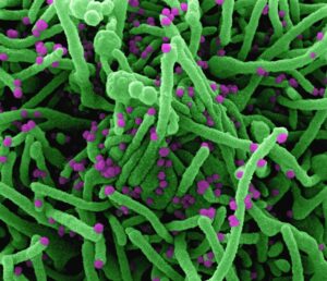 Bacteria in Biotechnology Tools for the Future