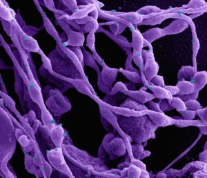 Lactic Acid Bacteria in Dairy Products