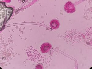 Soil Bacteria and Their Role in Agriculture